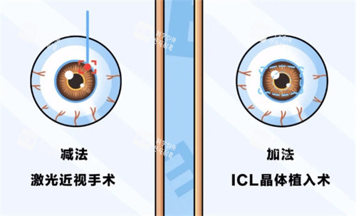 一目了然！北京近視眼手術價格一覽表，散光型ICL3.85萬起，不同術式適配人群全解析